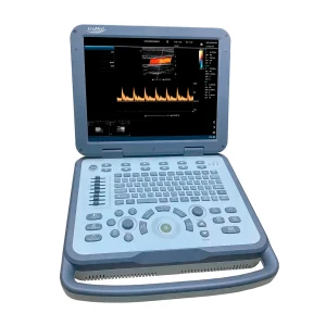 Ultrasonido Color Doppler 2D Portátil